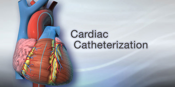 cardiac-catheterization